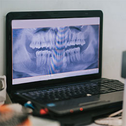 In-Office Membership Plan